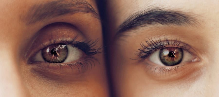 Close-up of two women's eyes, reflecting a scene. Cosmetic neurology.