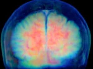 Brain scan showing colorful activity, illustrating the power of thought.
