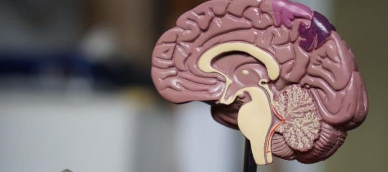 Detailed anatomical model of a human brain, highlighting key structures.