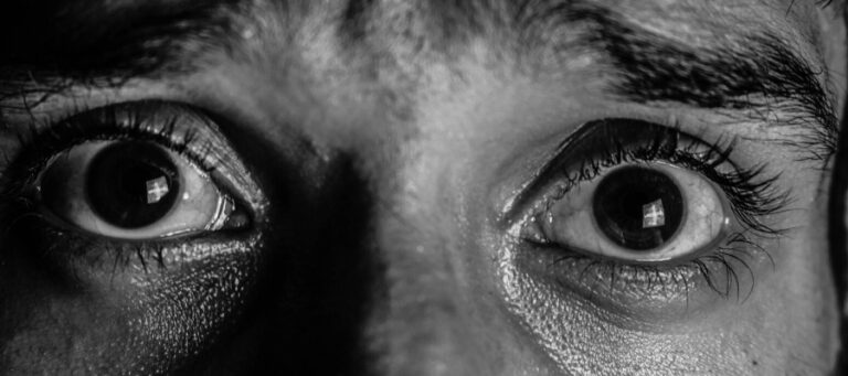 Close-up of a person's wide, expressive eyes.