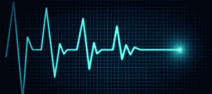 Flatline EKG heart monitor showing a cessation of heartbeat.